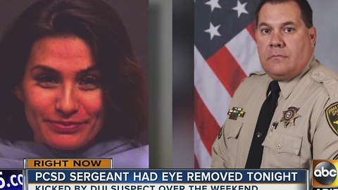 Pima County deputy has eye removed after woman kicks him in face