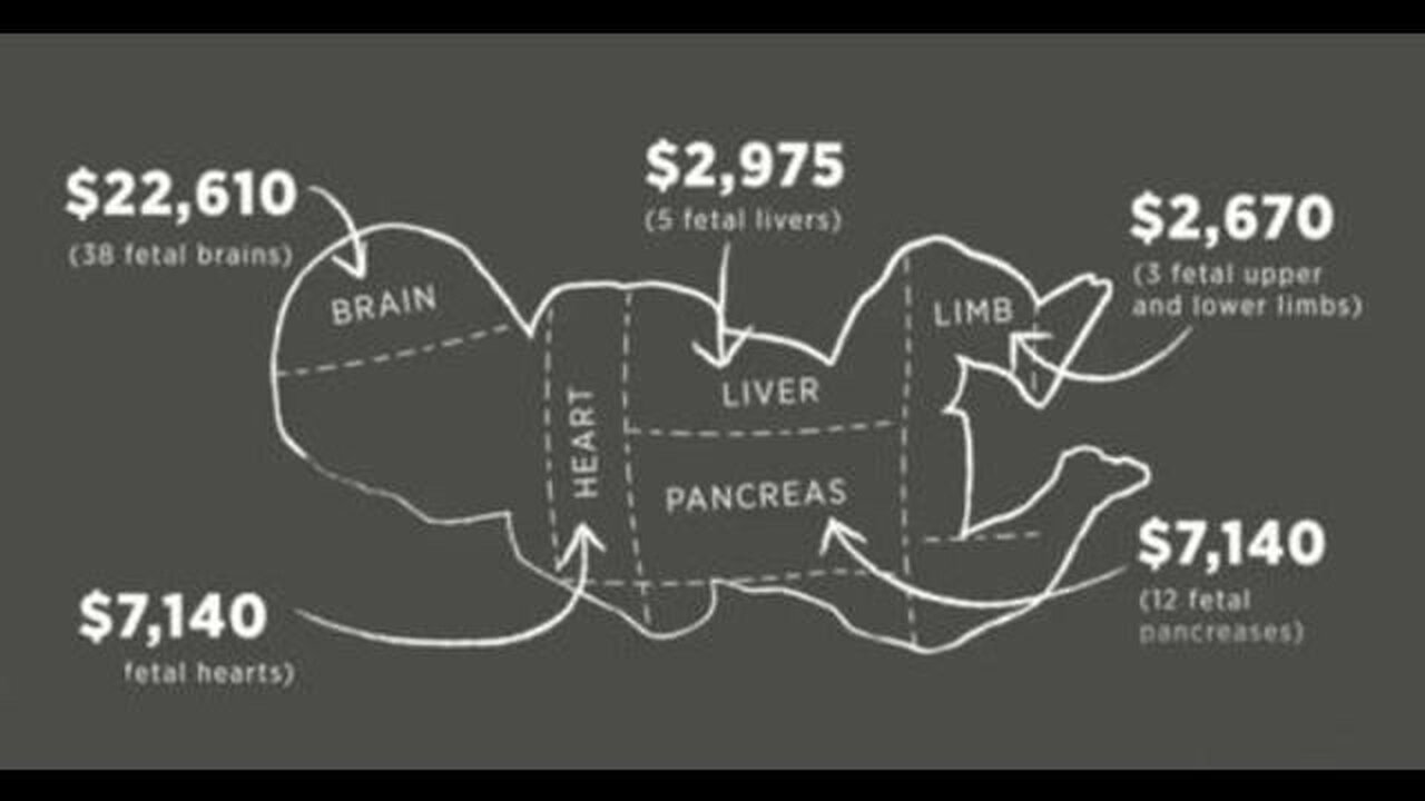 Organ Harvesting - Total Body Worth: $45,618,575.82