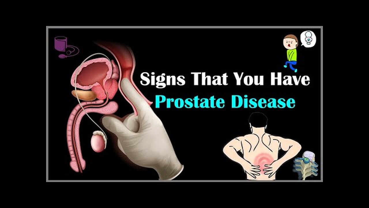 Signs That You Have Prostate Disease