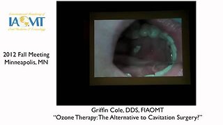 Dr Griffin Cole "Ozone Therapy: An Alternative to Cavitation Surgery?" IAOMT 2012 Minneapolis