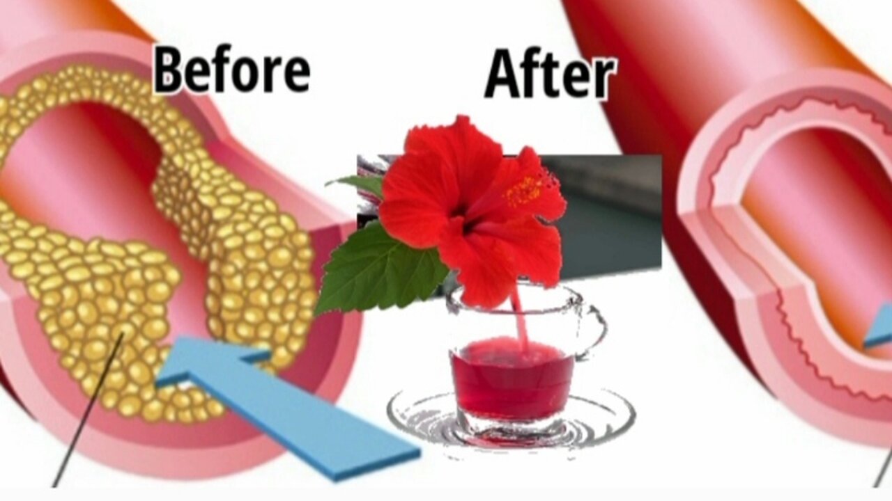 Natural Treatment for high blood pressure