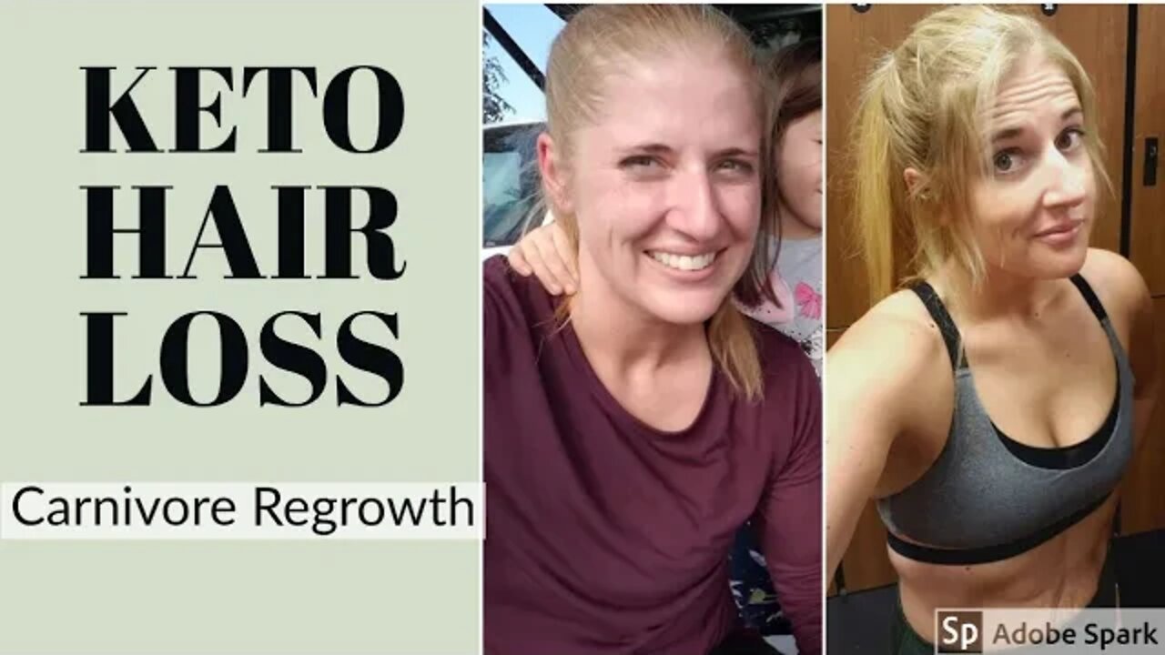 Keto Hair Loss, Carnivore Regrowth