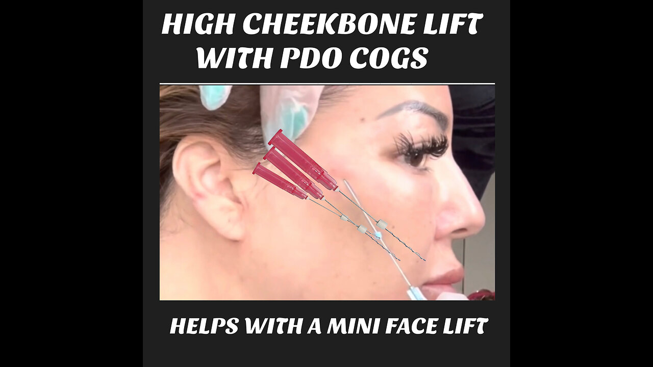 Adding Cogs For High cheek Bones