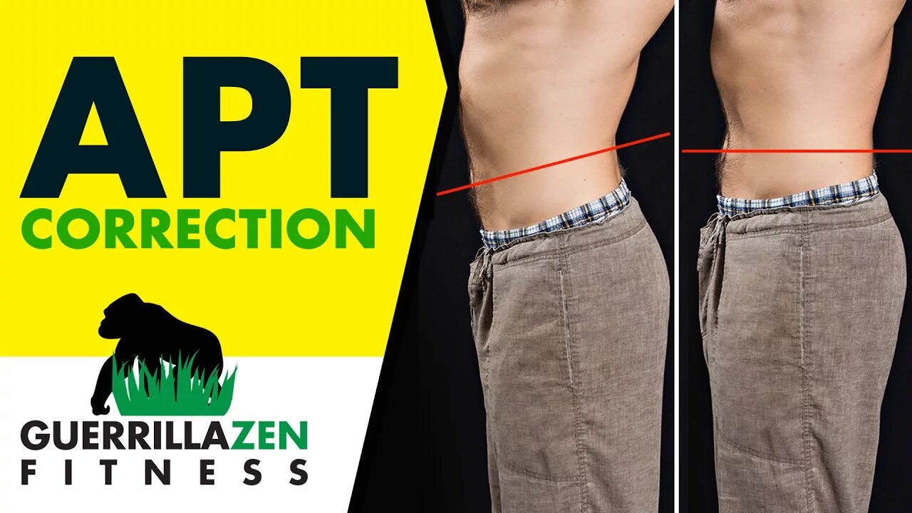 Anterior Pelvic Tilt Before and After