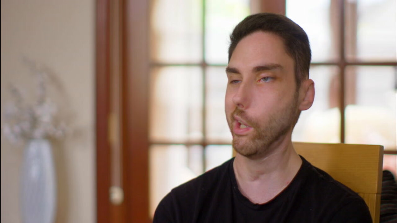 Half My Face Is Paralysed - Will My Blind Date Care? | DATING DIFFERENT