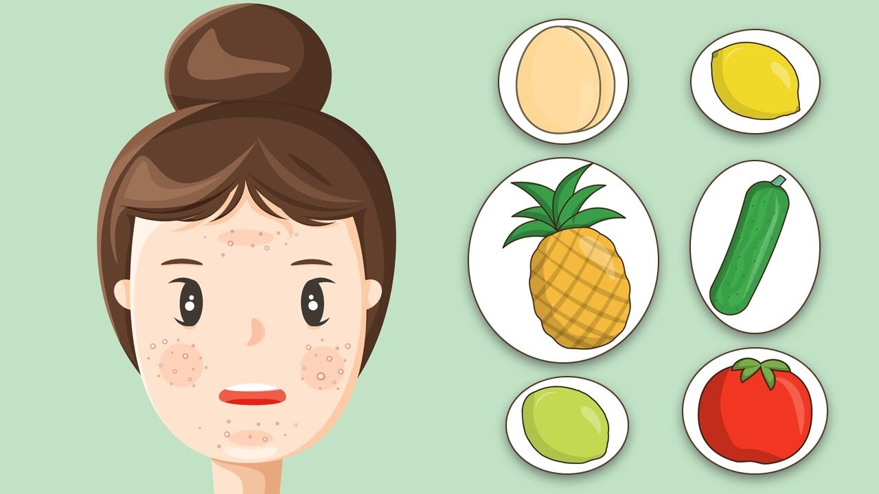 6 Home Remedies to Get Rid of Oily Skin