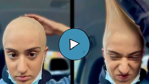 A Viral Really Stretchy head