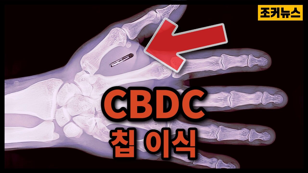 "CBDC가 칩 이식이 될 것 경고" Warns CBDC will become an implantable chip