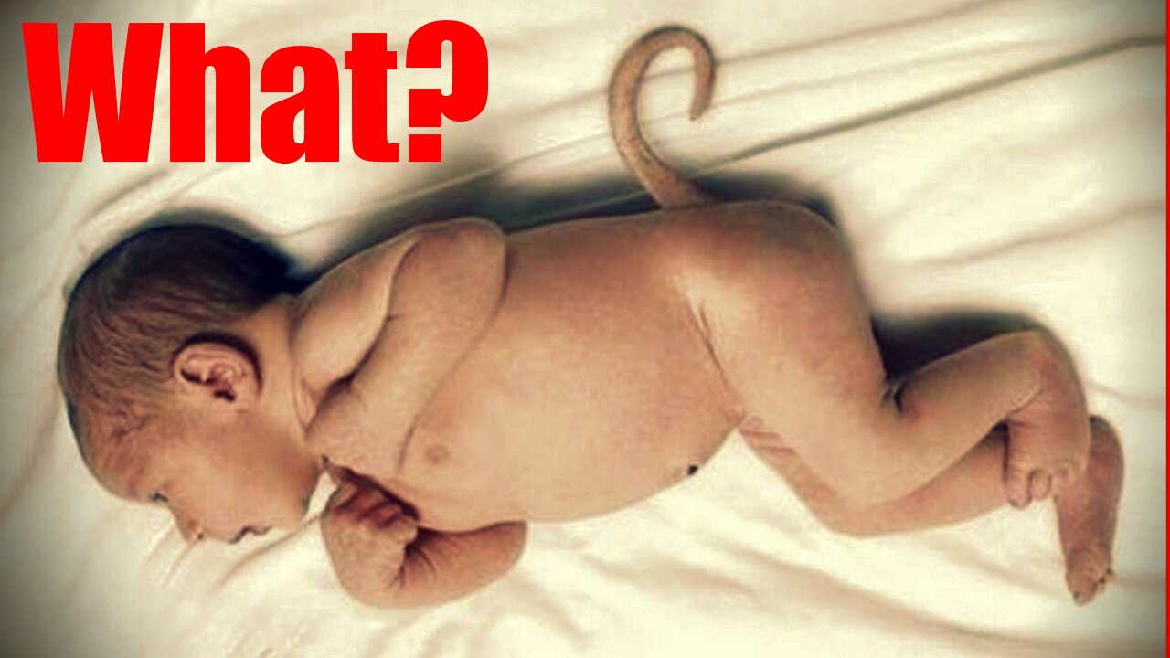 “Babies could be born with tails and animal hair!” say Turkish doctors