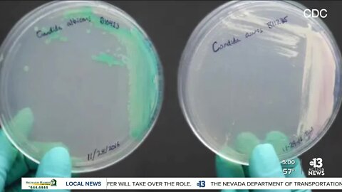 Fungal infection in local hospitals raises concerns for families and medical experts