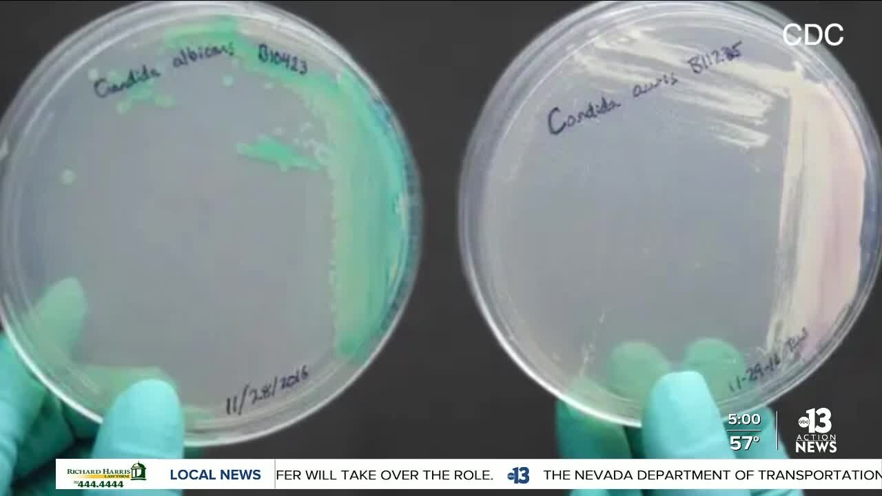 Fungal infection in local hospitals raises concerns for families and medical experts