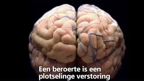 Tekenen waaraan je een beroerte kunt herkennen.