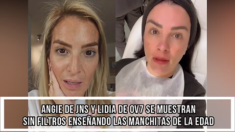 ANGIE DE JNS Y LIDIA DE OV7 SE MUESTRAN SIN FILTROS ENSEÑANDO LAS MANCHITAS DE LA EDAD