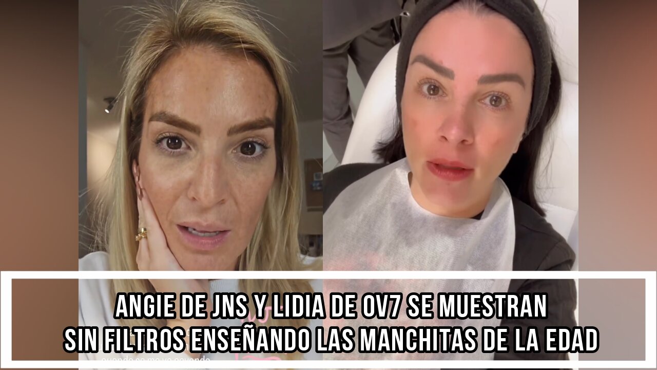 ANGIE DE JNS Y LIDIA DE OV7 SE MUESTRAN SIN FILTROS ENSEÑANDO LAS MANCHITAS DE LA EDAD