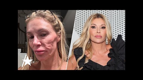 Brandi Glanville SHOCKS Fans With Unrecognizable Selfie Amid Health Struggles