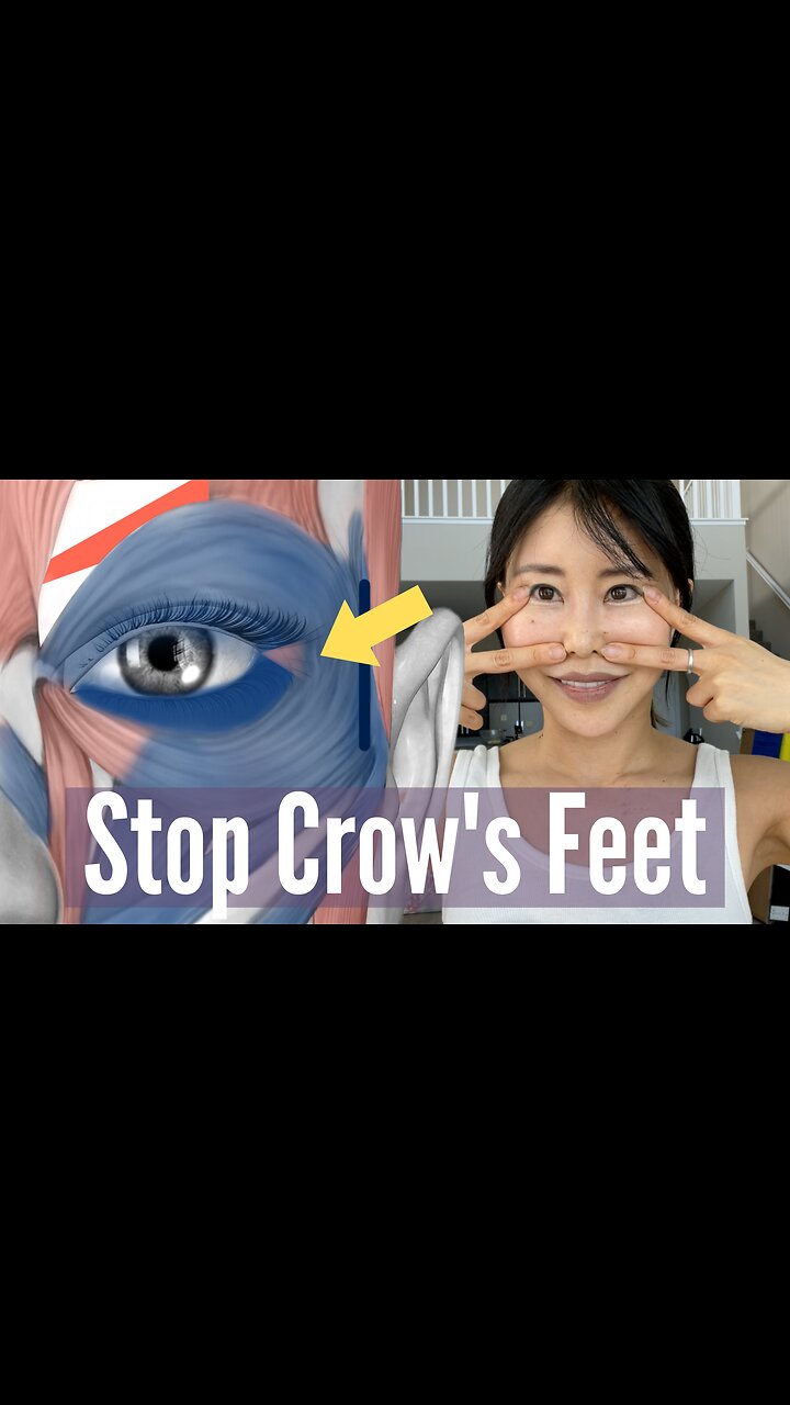 Face yoga for crow's feet sale