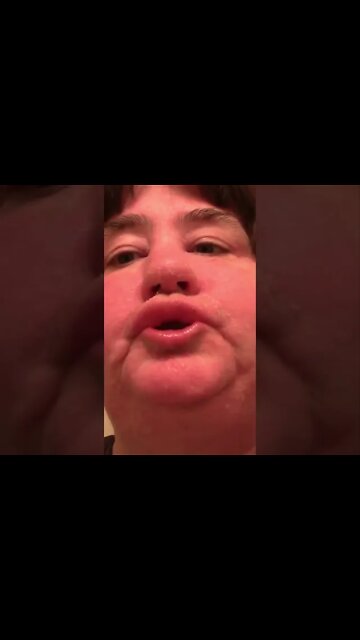 Poor Man's Botox #Shorts 🙄