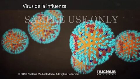 Neumonía