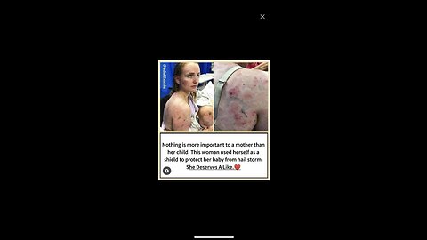 Woman used herself as a shield to protect her baby from hail storm