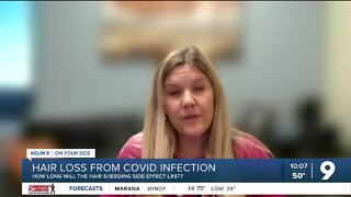 Hair loss becomes common side-effect of COVID-19