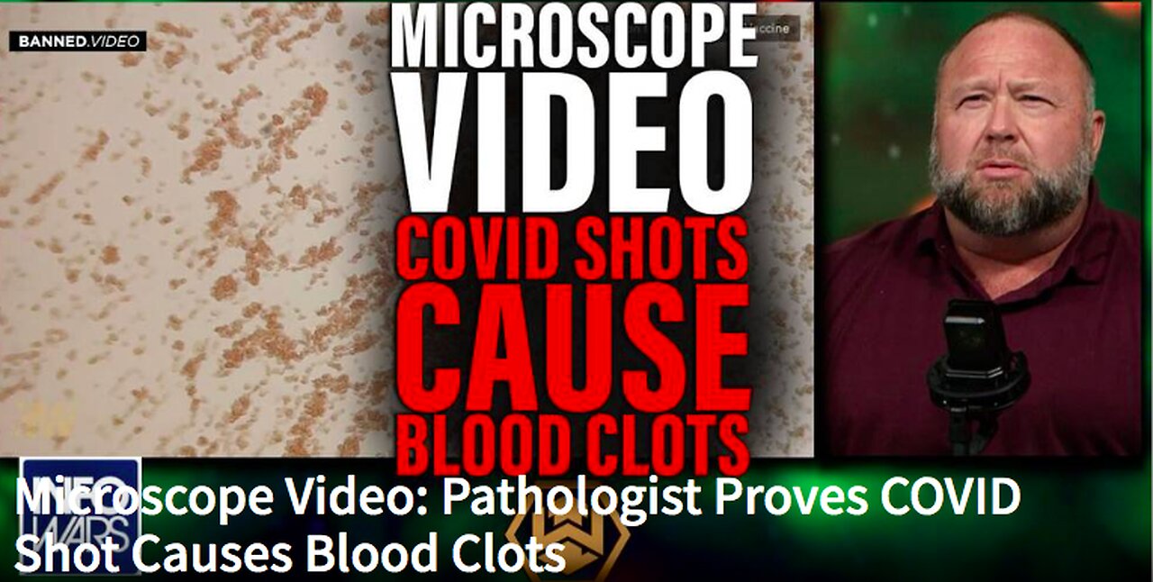 Microscope Video: Pathologist Proves COVID Shot Causes Blood Clots