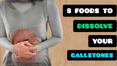 " Gallbladder Stone: 8 Superfoods to Add to Your Diet If You Have Gallstone."