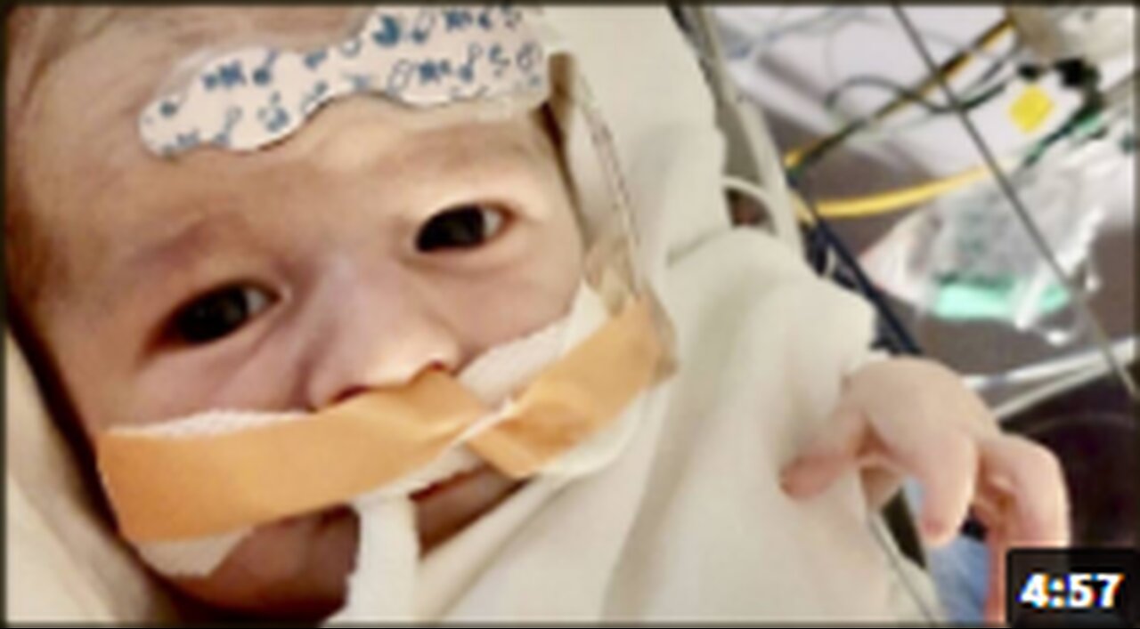 Baby Given Vaccinated Blood Infusion Dies Within Days From Blood clot