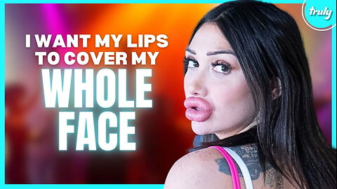 People Pay For Me To Get Lip Fillers | HOOKED ON THE LOOK