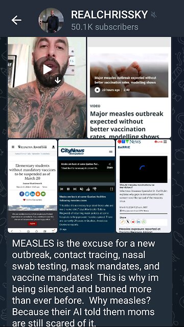 Chris Sky talks about Measles