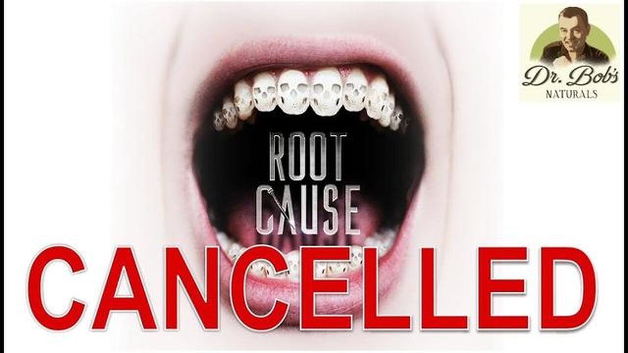 NETFLIX Pulls Documentary on Root Canals Causing CANCER ☤ After Dentists Threatened to Sue