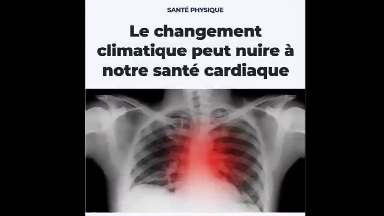 Les nouvelles causes de crises cardiaques