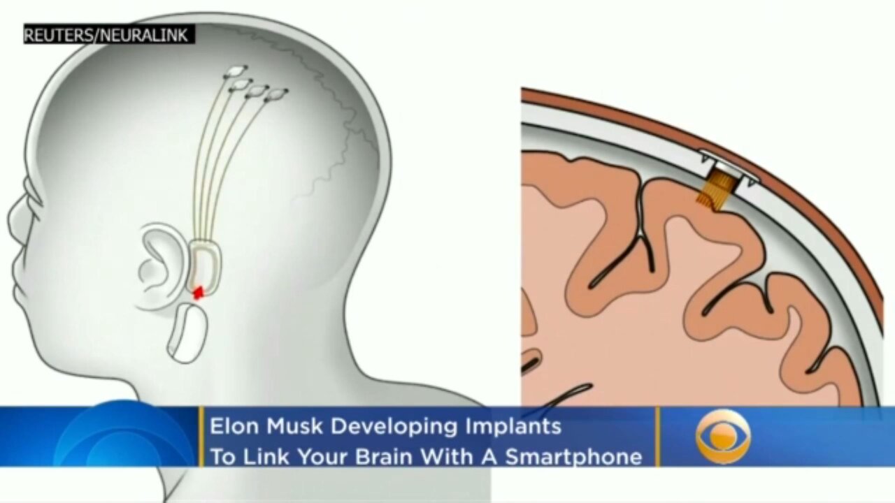 Elon Musk Elon Musk Is Making Implants To Link YOUR Brain With A Smartphone