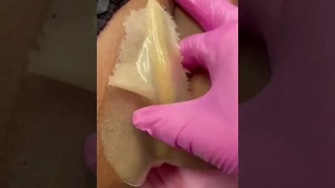 Hydrojelly Mask Removal