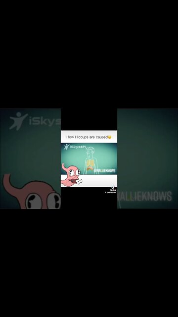 How Hiccups Are Caused