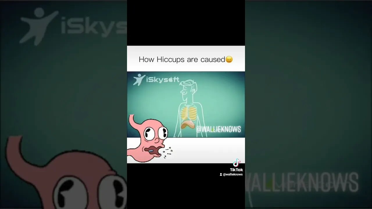 How Hiccups Are Caused