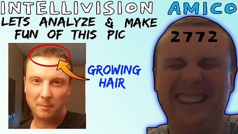 Intellivision Amico Darius Truxton Tries Growing Hair/Beard But Humiliates Himself - 5lotham