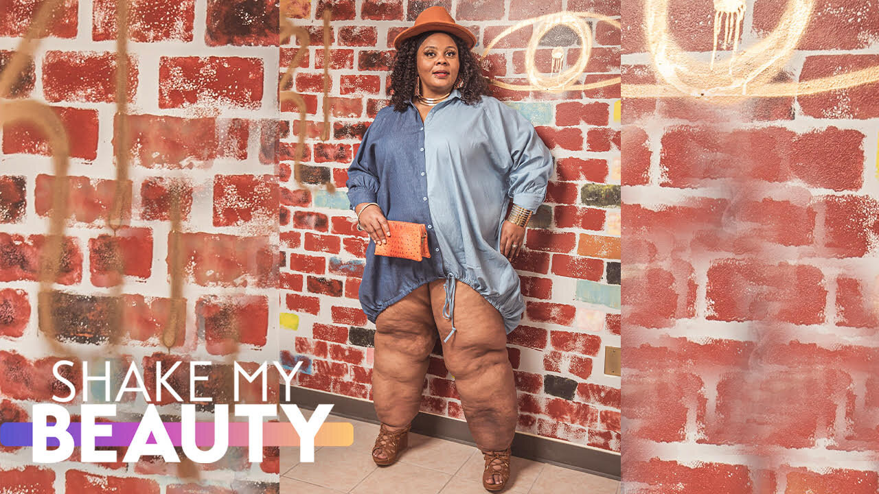 I've Hidden My Lipedema Legs - Until Today | SHAKE MY BEAUTY