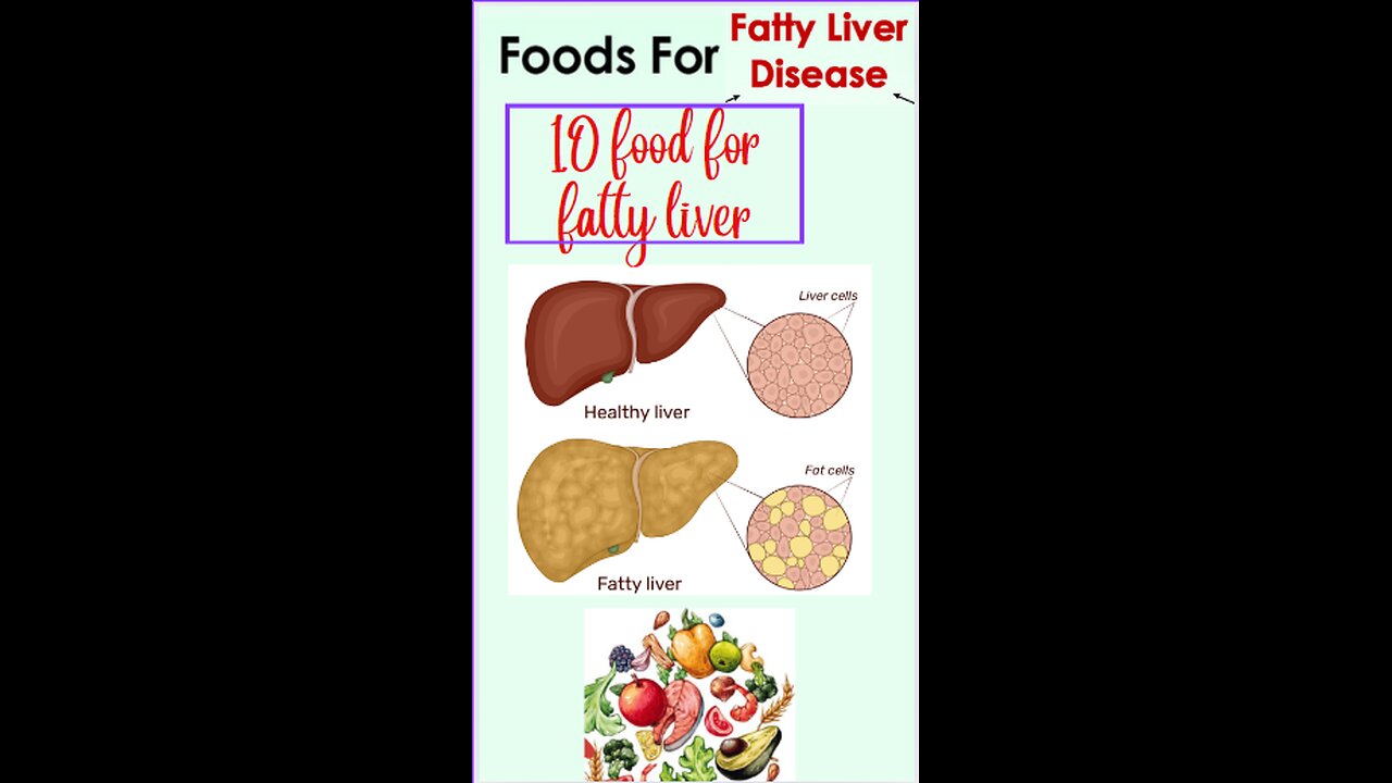 10 Superfoods That Can Heal a Fatty Liver.