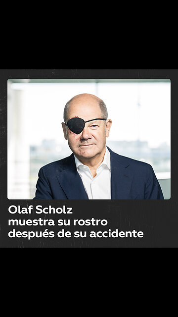 El canciller alemán, Olaf Scholz, publicó una foto después de su “accidente deportivo”