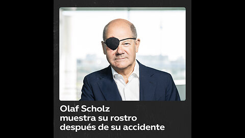 El canciller alemán, Olaf Scholz, publicó una foto después de su “accidente deportivo”