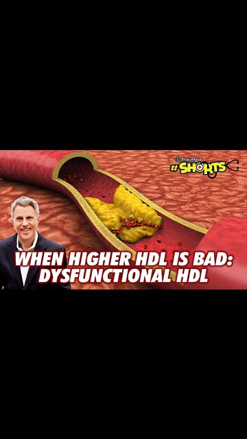 #SHORTS When Higher HDL is Bad - Dysfunctional HDL
