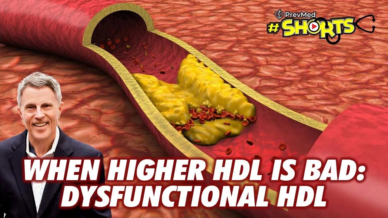 #SHORTS When Higher HDL is Bad - Dysfunctional HDL