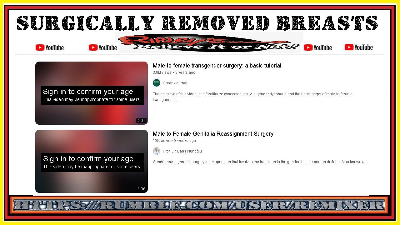 SURGICALLY REMOVED BREASTS