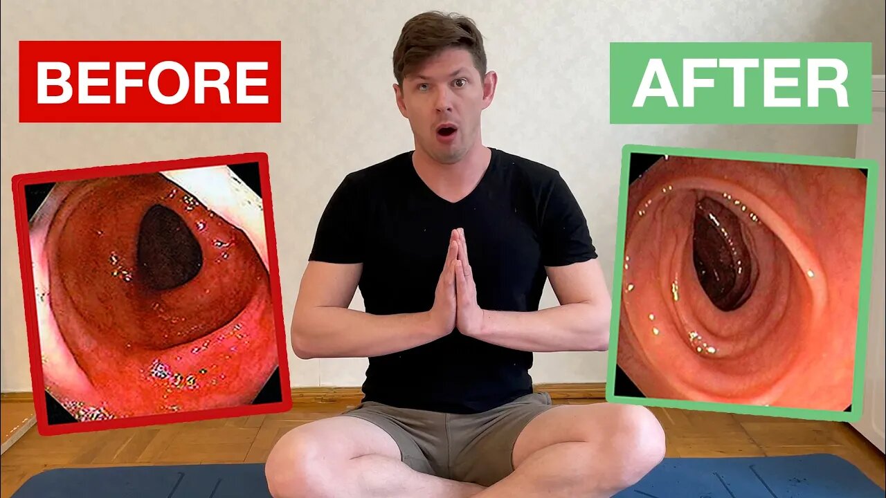 How Meditation Alone Heals Crohn's If You Avoid These 3 Mistakes