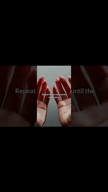 Your Wart Will Fall Off Quickly After Applying This Mixture #shorts