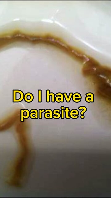 Do I have a parasite? Probably not….