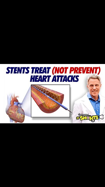 #SHORTS Stents Treat (But Don’t Prevent) Heart Attacks
