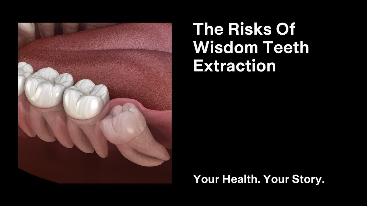 The Risks Of Wisdom Teeth Extraction