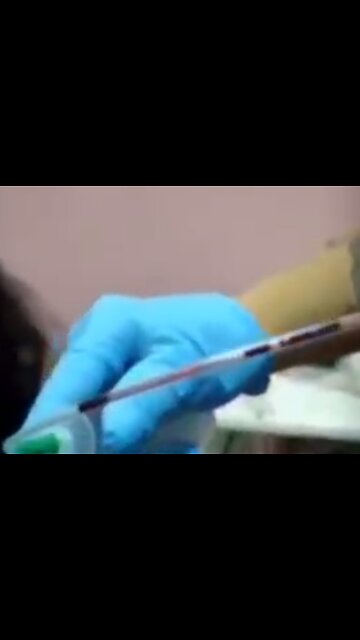 Vaccinated Blood like GEL & is USELESS for Red Cross