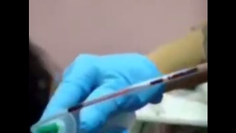 Vaccinated Blood like GEL & is USELESS for Red Cross
